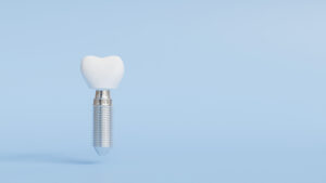 3D model of dental implant on blue background, dentistry