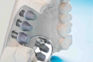 Close up implant and prosthodontic model